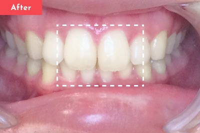 Case 05 After